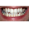 Icon-dientes